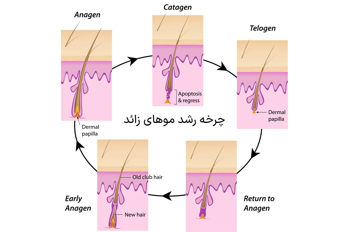 سن مناسب برای لیزر