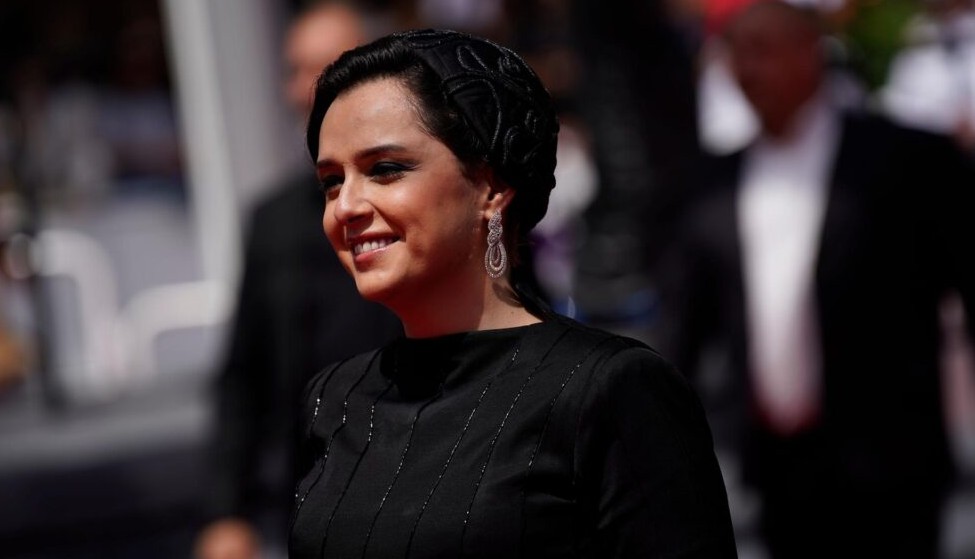 بیماری ترانه علیدوستی چیست؟ از سندرم DRESS تا دلیل تغییرات پوستی و دستها 1 ترانه علیدوستی