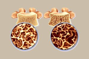 استخوان‌های شما دوباره زنده می‌شوند؛ کشف تازه‌ای در بازسازی طبیعی استخوان‌ها