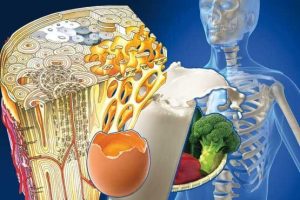 پوکی استخوان؛ چگونه تغذیه، مزاج و سبک زندگی سلامت استخوان را تعیین میکنند 2 پوکی استخوان؛ چگونه تغذیه، مزاج و سبک زندگی سلامت استخوان را تعیین میکنند